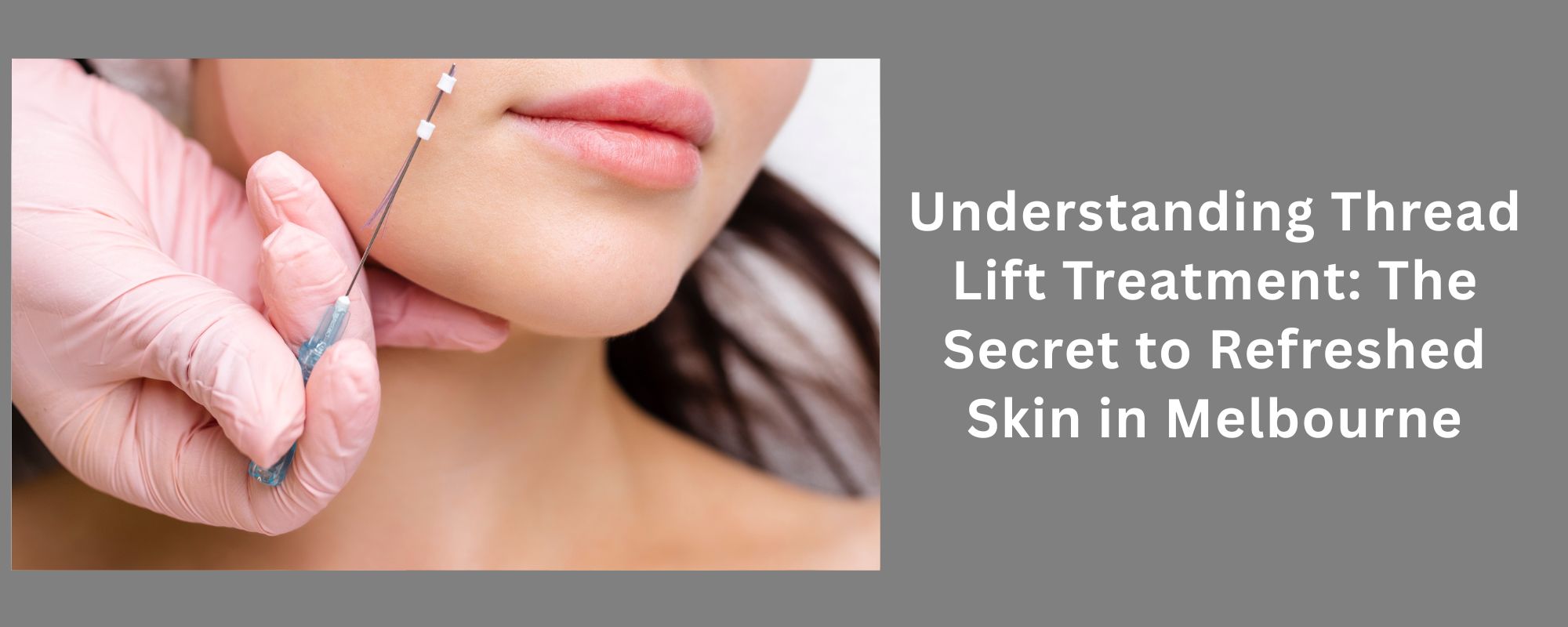 Thread Lift Treatment