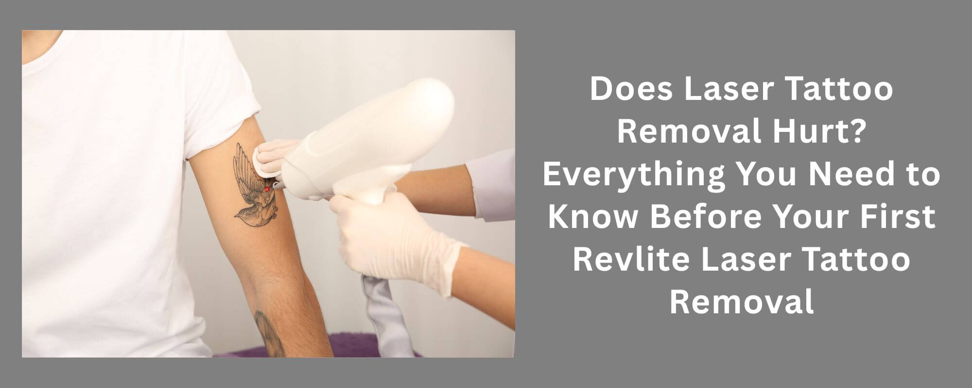Does Laser Tattoo Removal Hurt? Everything You Need to Know Before Your First Revlite Laser Tattoo Removal 1 Laser Tattoo Removal in Melbourne