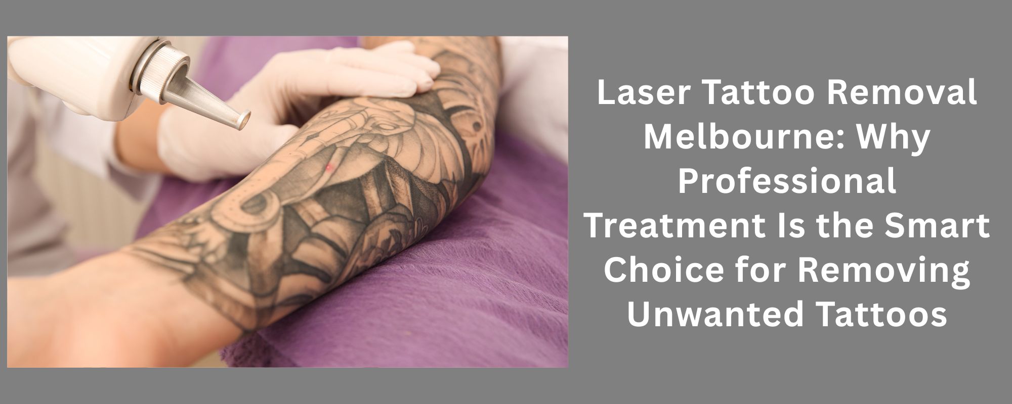 Laser Tattoo Removal Melbourne: Why Professional Treatment Is the Smart Choice for Removing Unwanted Tattoos 1 Laser Tattoo Removal Melbourne