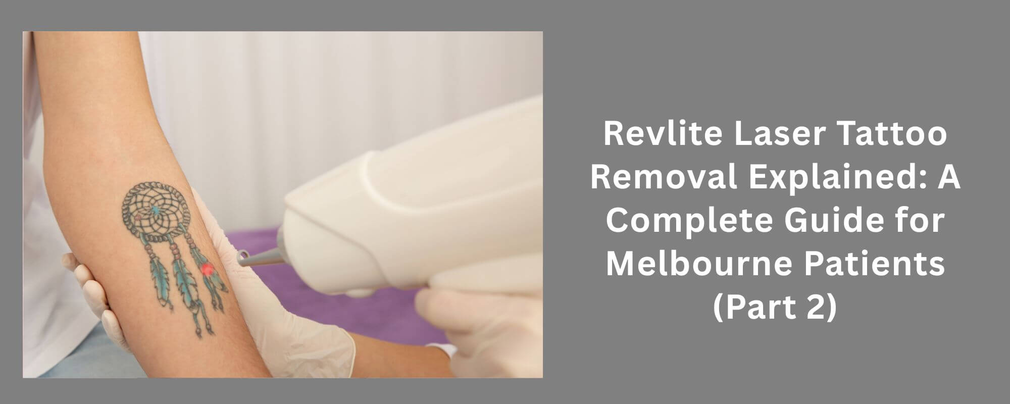 Laser Tattoo Removal in Melbourne