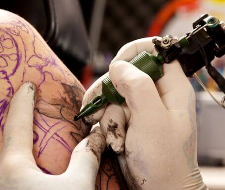 Revlite Laser Tattoo Removal Explained: A Complete Guide for Melbourne Patients