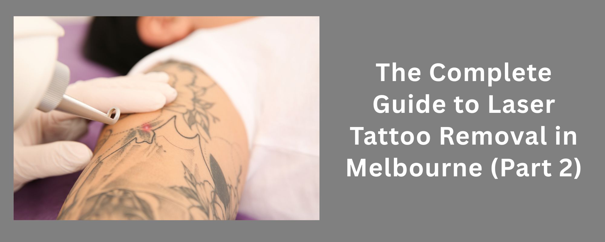 The Complete Guide to Laser Tattoo Removal in Melbourne (Part 2) 1 Laser Tattoo Removal Melbourne